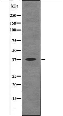 RAD51 (Phospho-Thr309) antibody