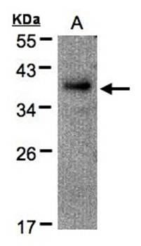 RAD51AP1 antibody