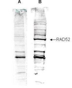 RAD52 antibody