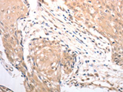 RAD52 Antibody
