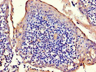 RAD54B antibody