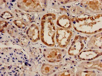 RAD9A Antibody