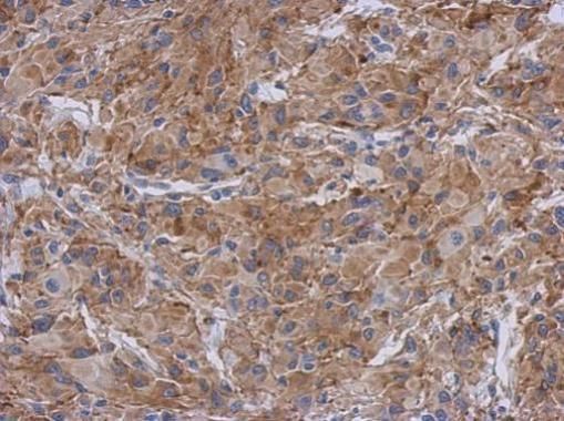 Radixin Rabbit Polyclonal Antibody
