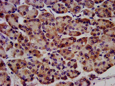 RAF1 Antibody