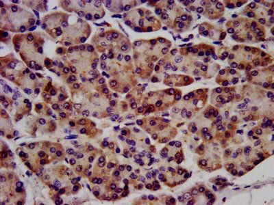 RAF1 antibody