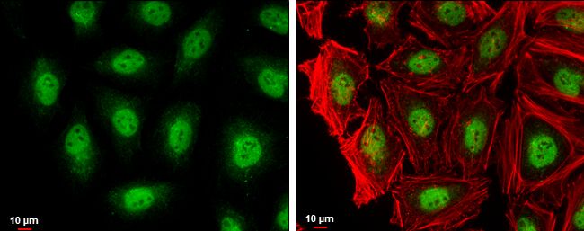 RAG2 antibody