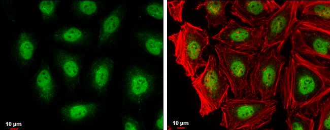 recombination activating 2 Antibody