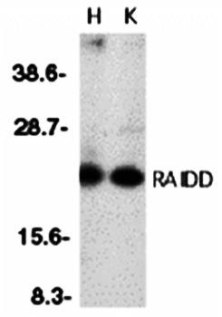 RAIDD Antibody