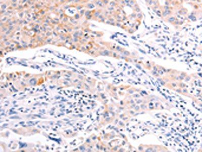 RALA Antibody