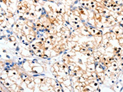 RALB Antibody