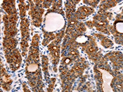 RAMP1 Antibody