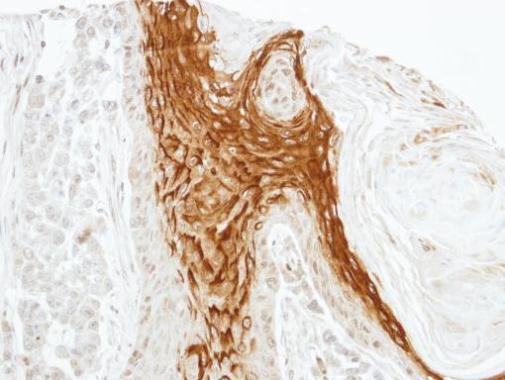 RAMP2 antibody