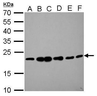 RAMP2 Rabbit Polyclonal Antibody