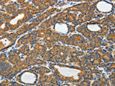 RAMP3 Antibody