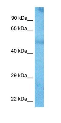 RANB9 antibody
