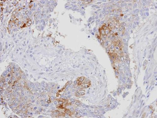 RanBP16 Rabbit Polyclonal Antibody