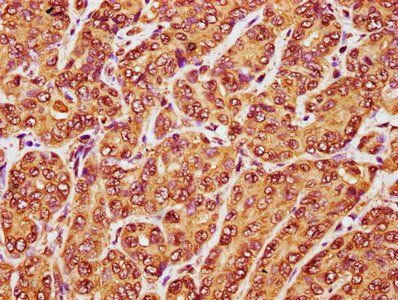 RANBP17 Antibody