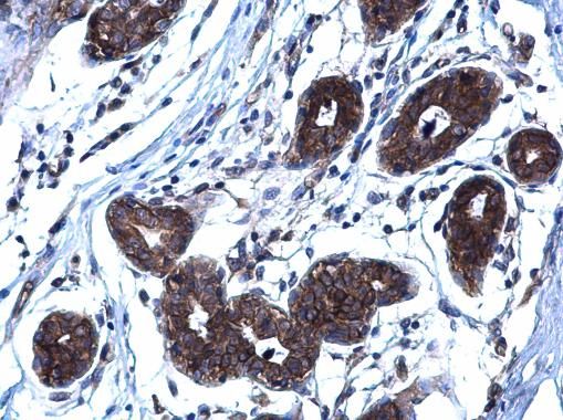 RANKL antibody [C2C3], C-term