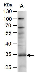 RANKL Rabbit Polyclonal Antibody