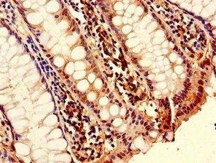 TNFSF11 Antibody