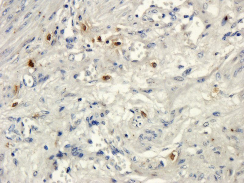 RANKL antibody