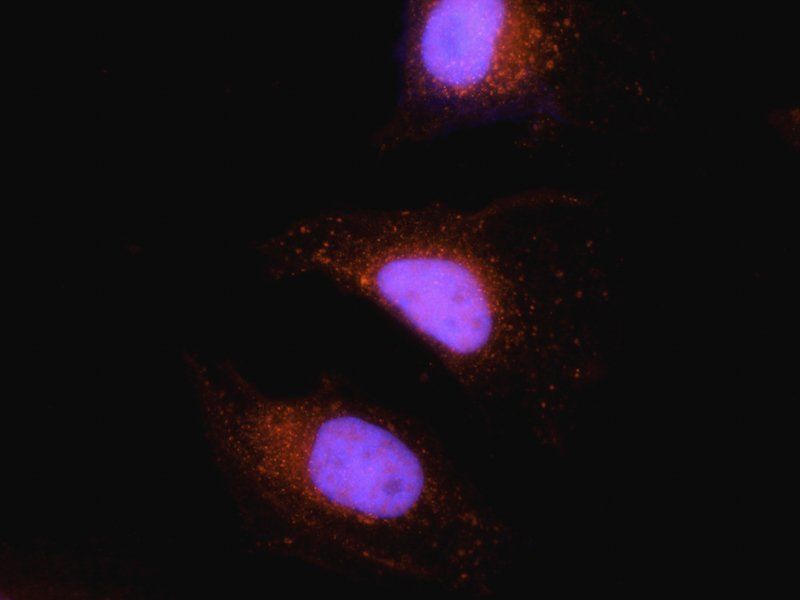 RANTES antibody