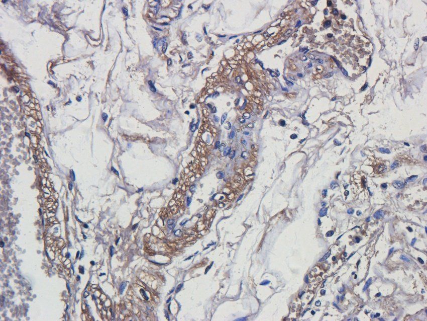 RANTES antibody