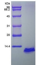 RANTES protein