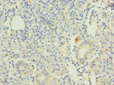 RAP1A Antibody