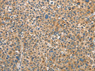RAP1A Antibody