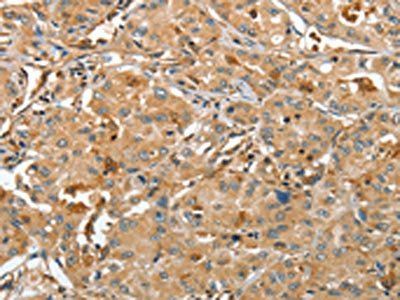 RAP1A Antibody