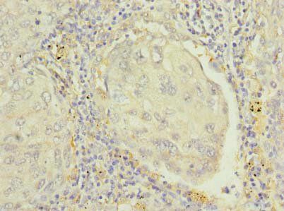 RAP1B Antibody
