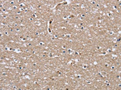 RAP1B Antibody