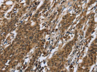 RAP1B Antibody
