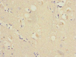 RAP2B Antibody