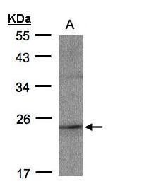 RAP2C Rabbit Polyclonal Antibody
