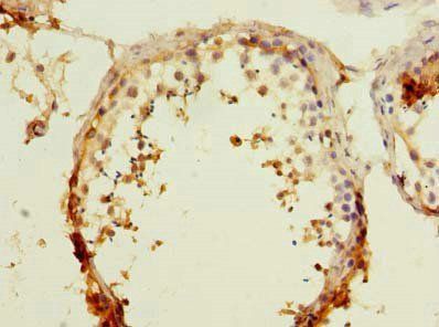 RAPGEF5 Antibody