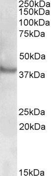 Goat anti-RAPSN / Rapsyn Antibody