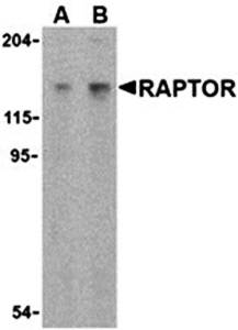 Raptor Antibody