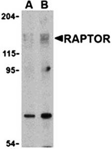 Raptor Antibody