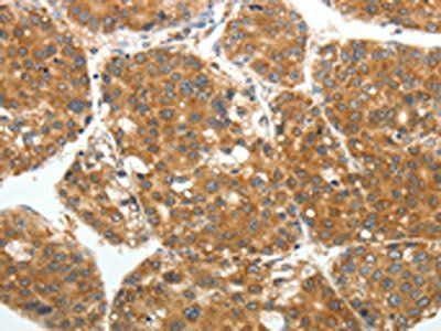 RARA Antibody