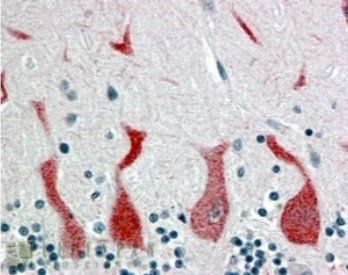 Goat anti-RARA Antibody