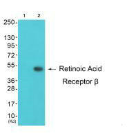 RARB antibody