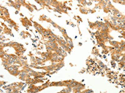 RARRES1 Antibody