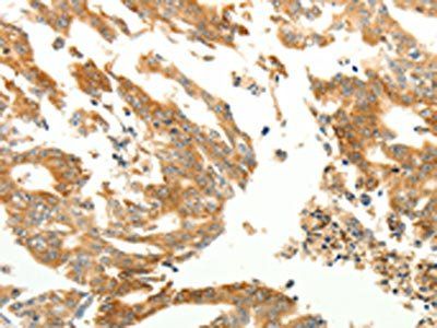 RARRES1 antibody