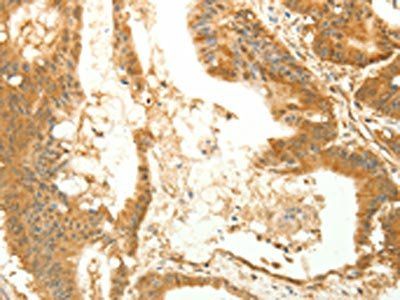RARRES1 Antibody