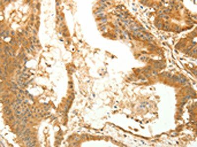 RARRES1 antibody