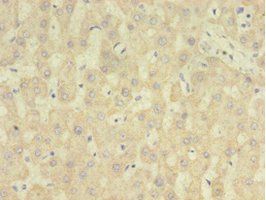 RARRES2 Antibody