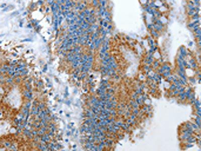 RARRES3 Antibody