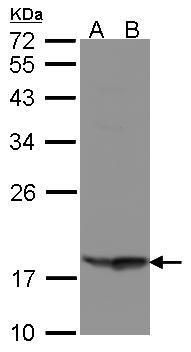 RARRES3 antibody